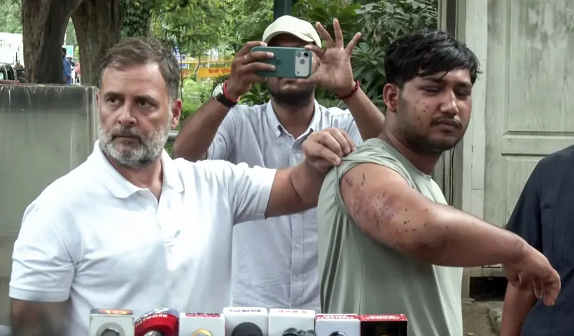 Jantar Mantar Protest: ଜନ୍ତର ମନ୍ତର ଆନ୍ଦୋଳନ ମାମଲାରେ ନୂଆ ମୋଡ଼, ଯୁବକଙ୍କ ଶରୀରରୁ ବାହାରିଲା ୭ଟି ପେଲେଟ୍
